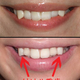 Image for article titled Japanese Cosmetic Dentistry Helps You Get That Sexy, Infantilized Smile